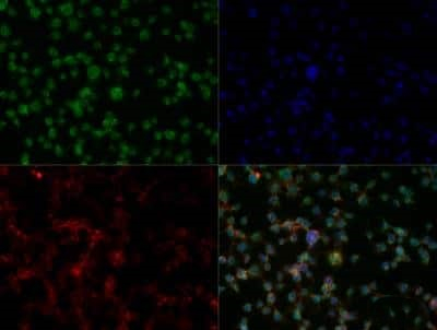 IKZF3 Antibody in Immunocytochemistry (ICC/IF)