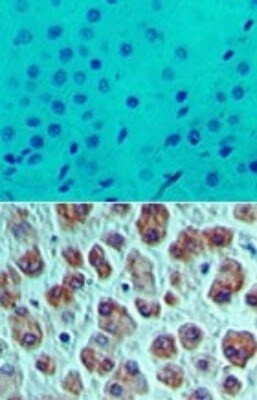 eIF4A1 Antibody in Immunohistochemistry (Paraffin) (IHC (P))