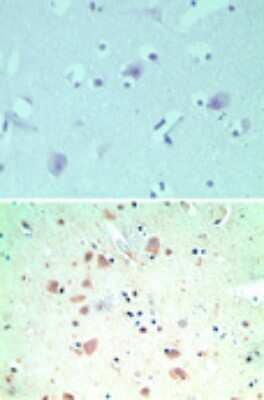 SNX2 Antibody in Immunohistochemistry (Paraffin) (IHC (P))