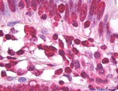 Histone H3.3 Antibody in Immunohistochemistry (Paraffin) (IHC (P))