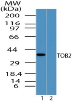 TOB2 Antibody in Western Blot (WB)