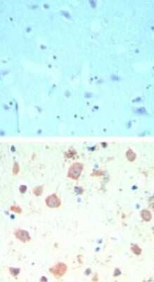 TIP60 Antibody in Immunohistochemistry (Paraffin) (IHC (P))