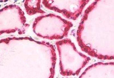 beta-Arrestin 2 Antibody in Immunohistochemistry (Paraffin) (IHC (P))