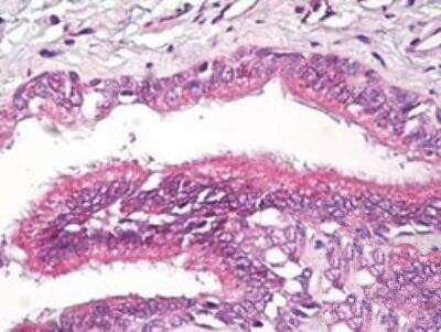 RAP2A Antibody in Immunohistochemistry (Paraffin) (IHC (P))