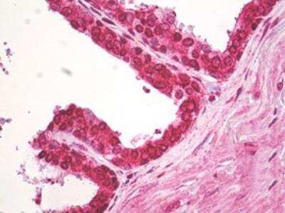 ACAP2 Antibody in Immunohistochemistry (Paraffin) (IHC (P))