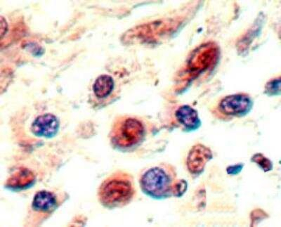 Neuropilin 1 Antibody in Immunohistochemistry (Paraffin) (IHC (P))