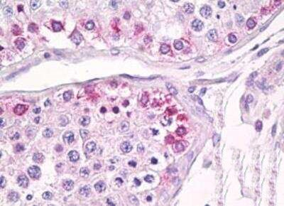 USP13 Antibody in Immunohistochemistry (Paraffin) (IHC (P))