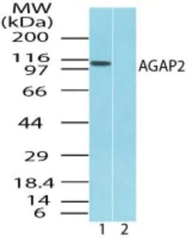 CENTG1 Antibody in Western Blot (WB)