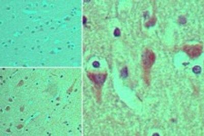 ASAP3 Antibody in Immunohistochemistry (Paraffin) (IHC (P))