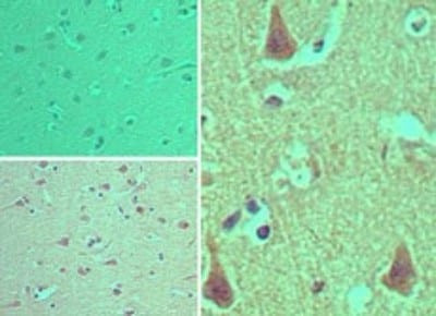 ARAP2 Antibody in Immunohistochemistry (Paraffin) (IHC (P))