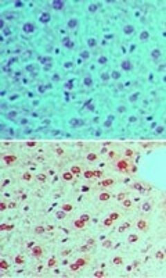 Phospho-RAD17 (Ser645) Antibody in Immunohistochemistry (Paraffin) (IHC (P))