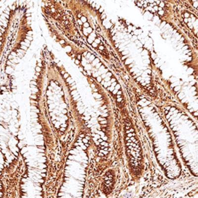 PLD2 Antibody in Immunohistochemistry (Paraffin) (IHC (P))