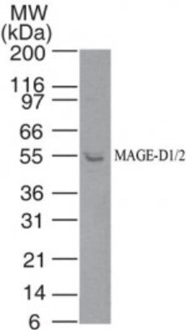 MAGED2 Antibody in Western Blot (WB)