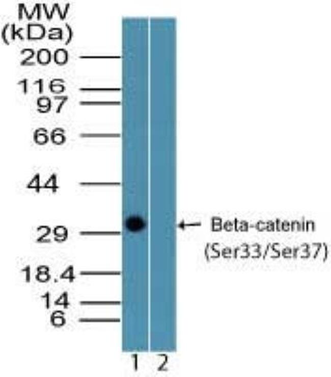 Phospho-beta Catenin (Ser33, Ser37) Antibody in Western Blot (WB)