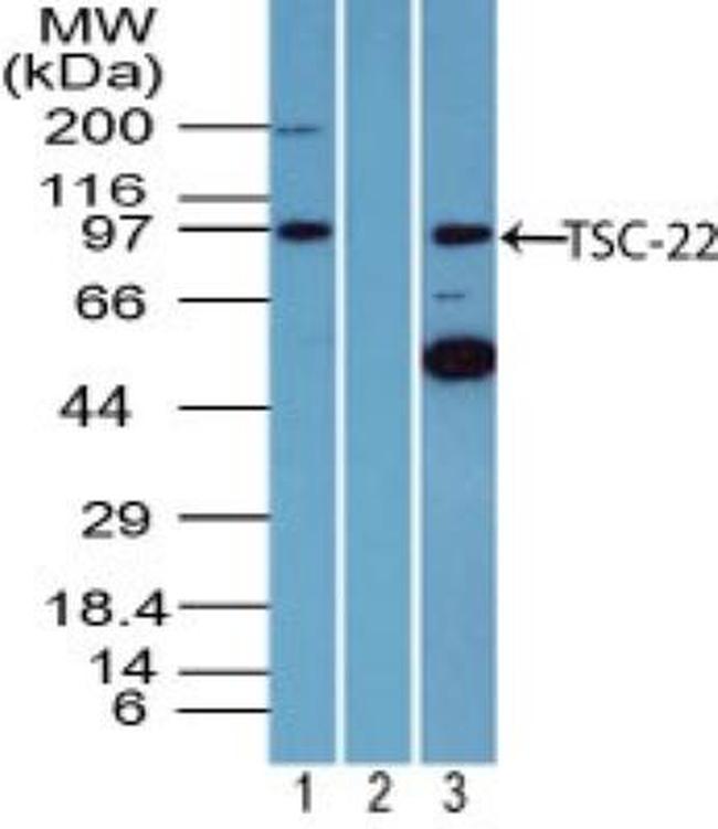 TSC22D1 Antibody in Western Blot (WB)