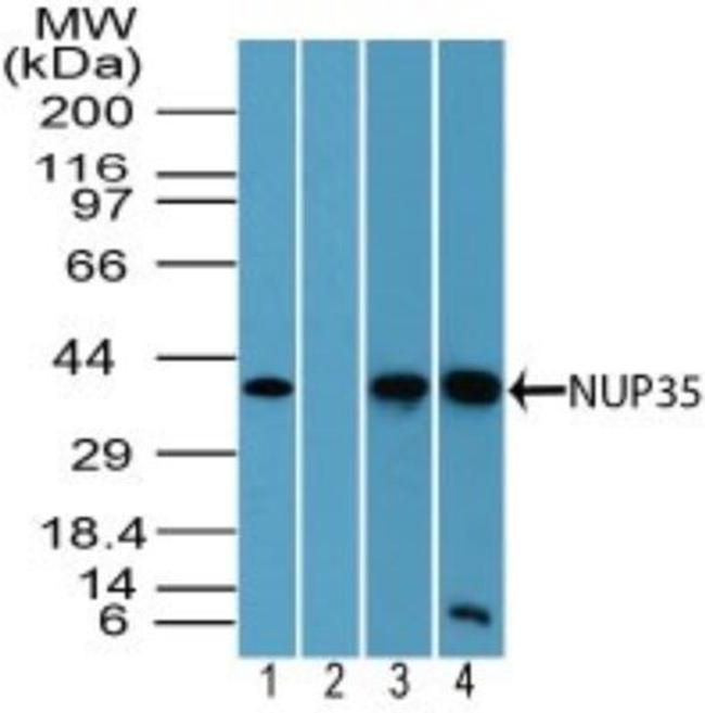 NUP35 Antibody in Western Blot (WB)