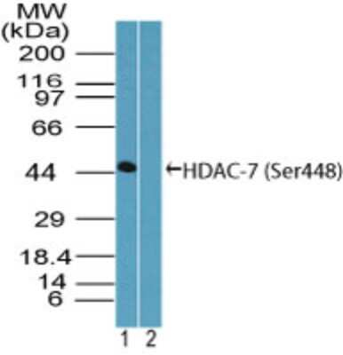 Phospho-HDAC7 (Ser448) Antibody in Western Blot (WB)