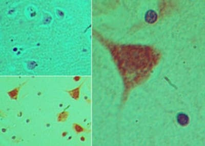 PER2 Antibody in Immunohistochemistry (Paraffin) (IHC (P))