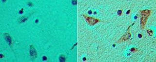 FLII Antibody in Immunohistochemistry (Paraffin) (IHC (P))
