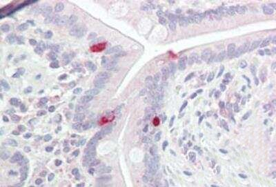 POU3F2 Antibody in Immunohistochemistry (Paraffin) (IHC (P))