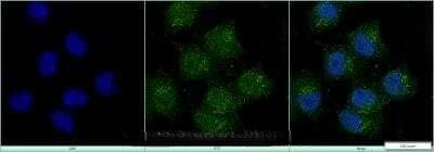 HB9 Antibody in Immunocytochemistry (ICC/IF)