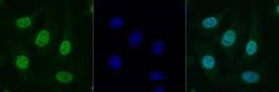 Histone H2A.X Antibody in Immunocytochemistry (ICC/IF)