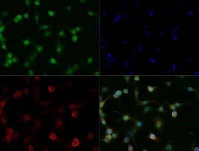 OLIG2 Antibody in Immunocytochemistry (ICC/IF)