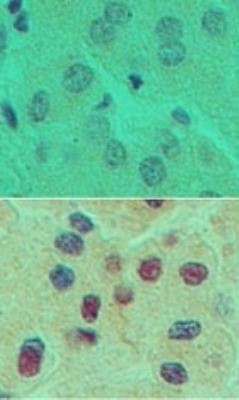 HNF6 Antibody in Immunohistochemistry (Paraffin) (IHC (P))