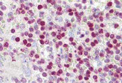 Histone H2A.X Antibody in Immunohistochemistry (Paraffin) (IHC (P))