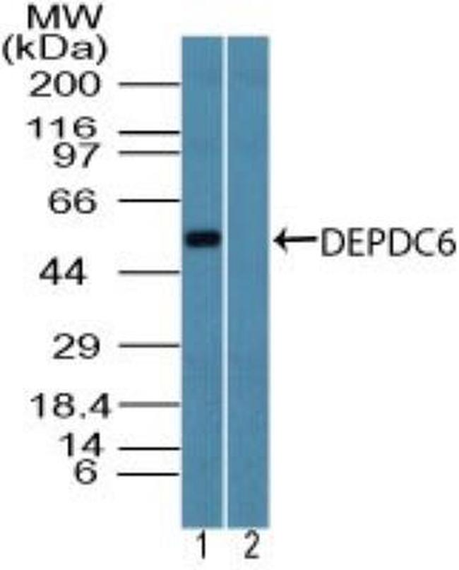 DEPDC6 Antibody in Western Blot (WB)