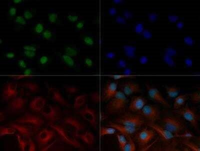 SNAIL Antibody in Immunocytochemistry (ICC/IF)