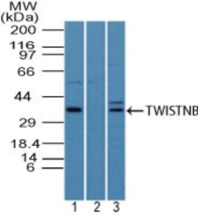 TWISTNB Antibody in Western Blot (WB)