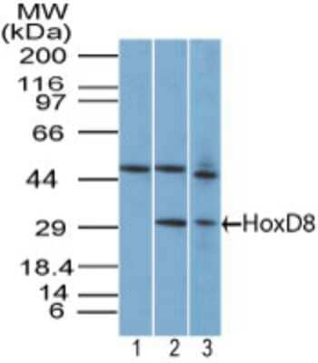HOXD8 Antibody in Western Blot (WB)