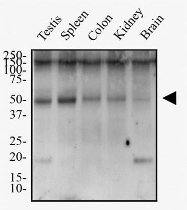 TMEM26 Antibody in Western Blot (WB)