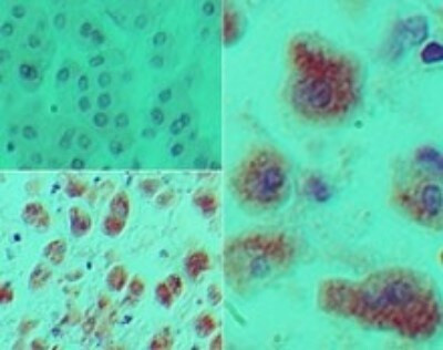 DACH1 Antibody in Immunohistochemistry (Paraffin) (IHC (P))
