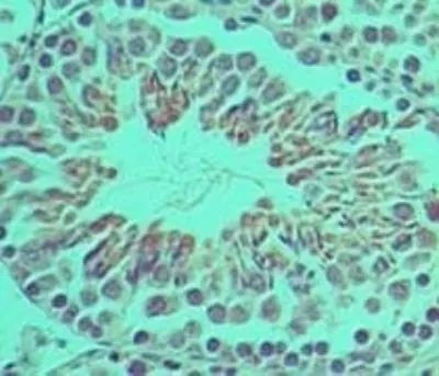 Ifi204 Antibody in Immunohistochemistry (Paraffin) (IHC (P))