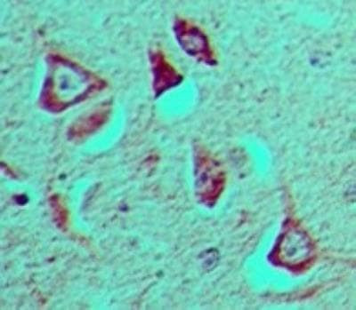 GFI1 Antibody in Immunohistochemistry (Paraffin) (IHC (P))