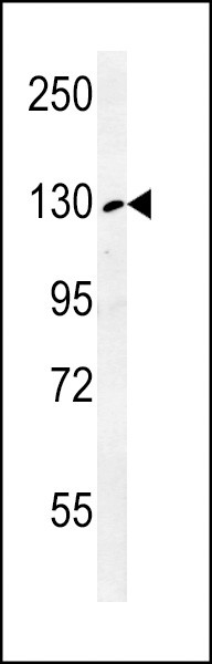 RTL1 Antibody in Western Blot (WB)