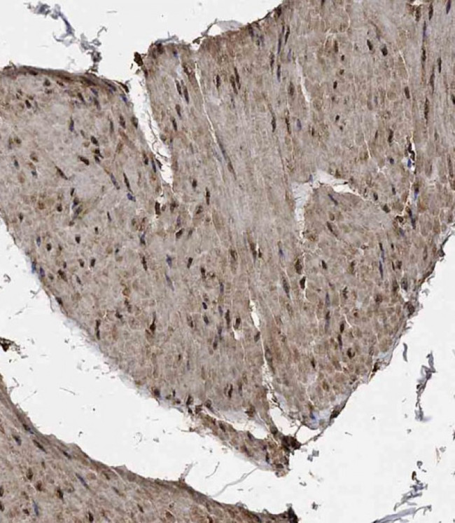METT10D Antibody in Immunohistochemistry (Paraffin) (IHC (P))