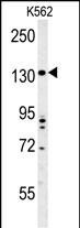 TMEM132D Antibody in Western Blot (WB)