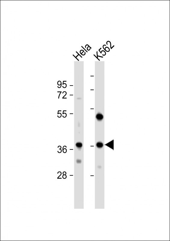 CTDSPL Antibody in Western Blot (WB)