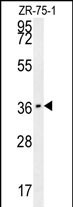 CLEC12A Antibody in Western Blot (WB)