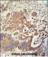 CHCHD2 Antibody in Immunohistochemistry (Paraffin) (IHC (P))