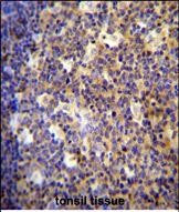 ALOX12B Antibody in Immunohistochemistry (Paraffin) (IHC (P))