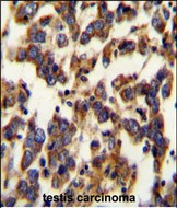 Seipin Antibody in Immunohistochemistry (Paraffin) (IHC (P))