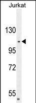 CENPC Antibody in Western Blot (WB)
