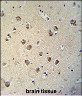 TECTB Antibody in Immunohistochemistry (Paraffin) (IHC (P))