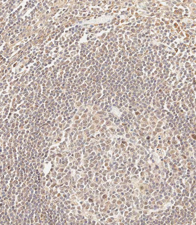 CEPT1 Antibody in Immunohistochemistry (Paraffin) (IHC (P))