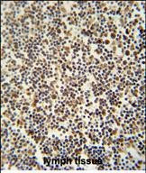 DENND1B Antibody in Immunohistochemistry (Paraffin) (IHC (P))