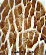 AP1S3 Antibody in Immunohistochemistry (Paraffin) (IHC (P))